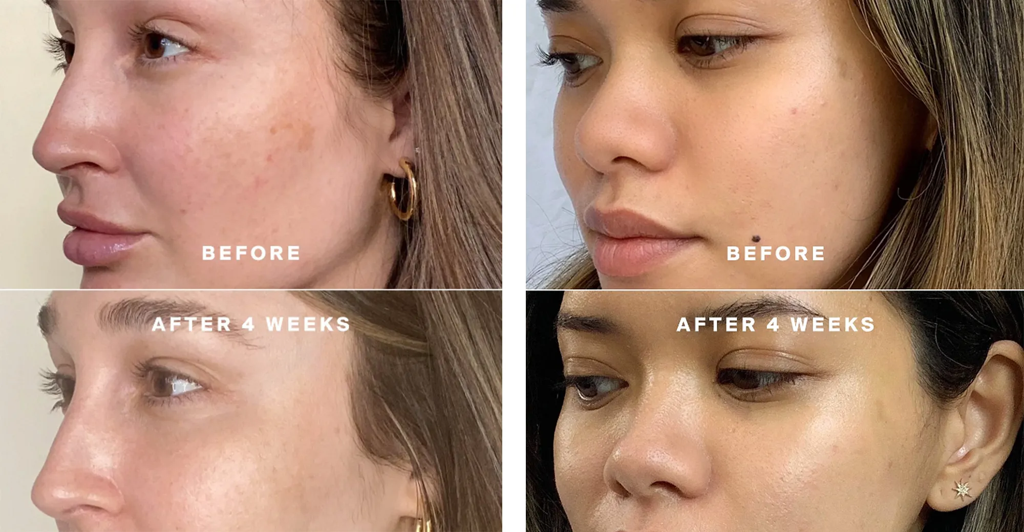 supergoop-before-after