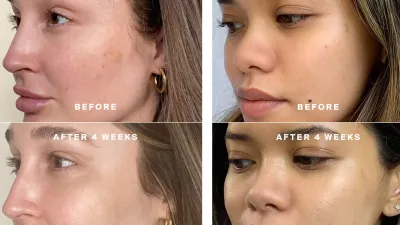 supergoop-before-after