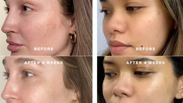 supergoop-before-after