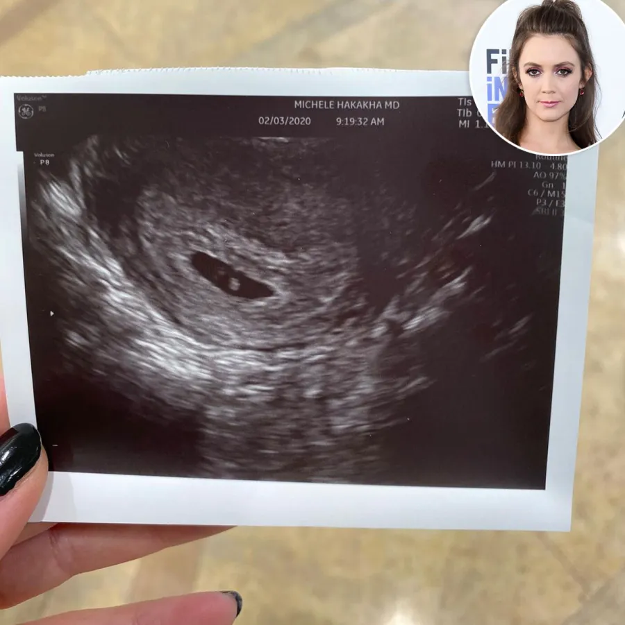 Pregnant Stars Share Ultrasound Pics