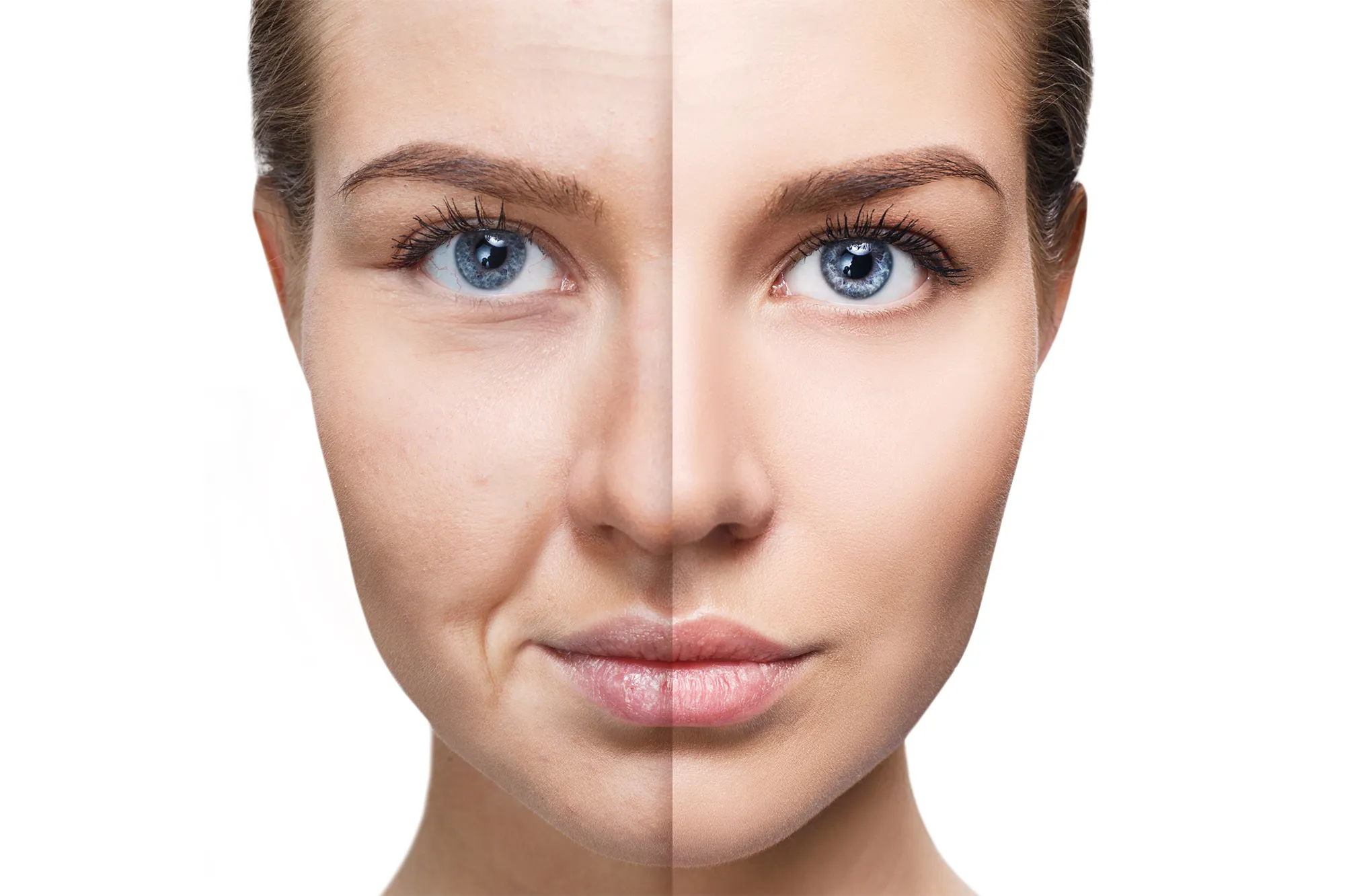 Dull-Skin-Before-After-Stock-Photo