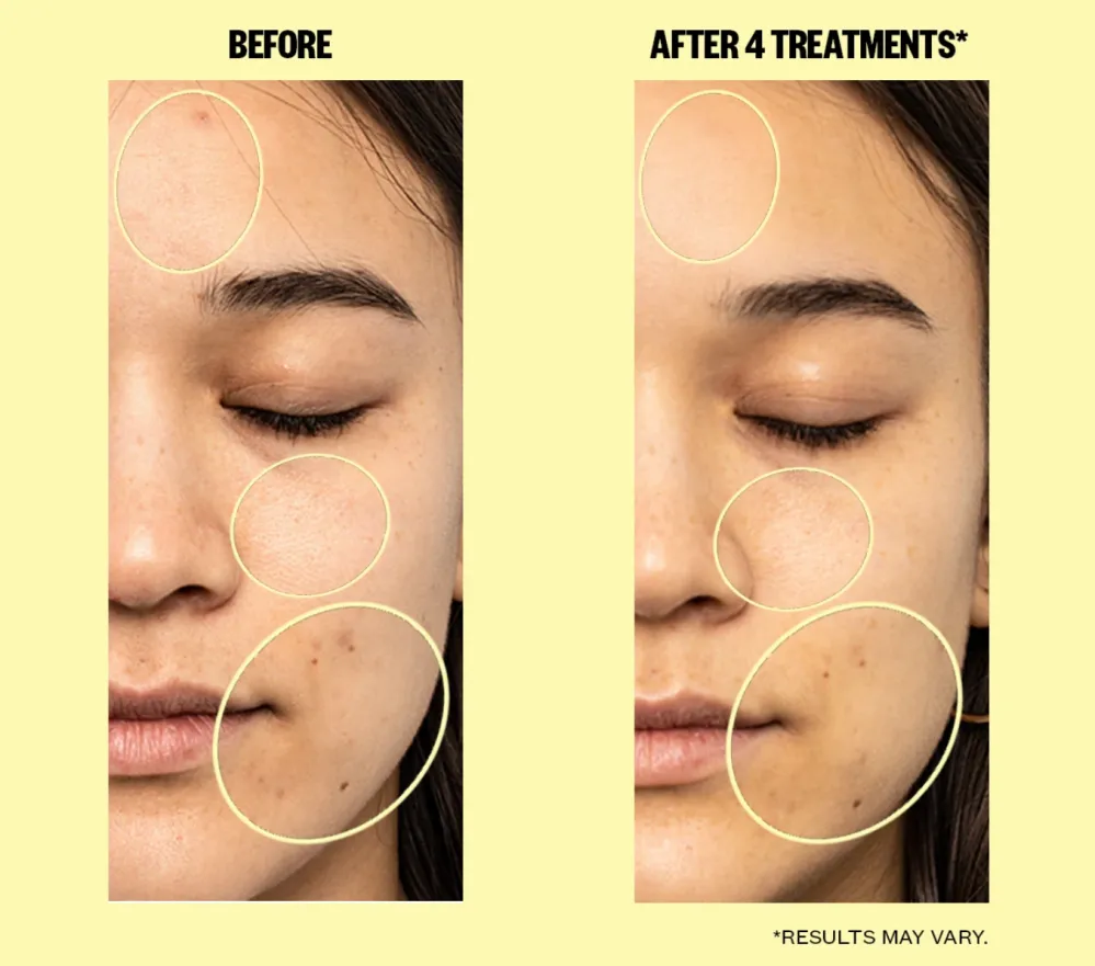 Dullness One-Step Brightening Face Pads