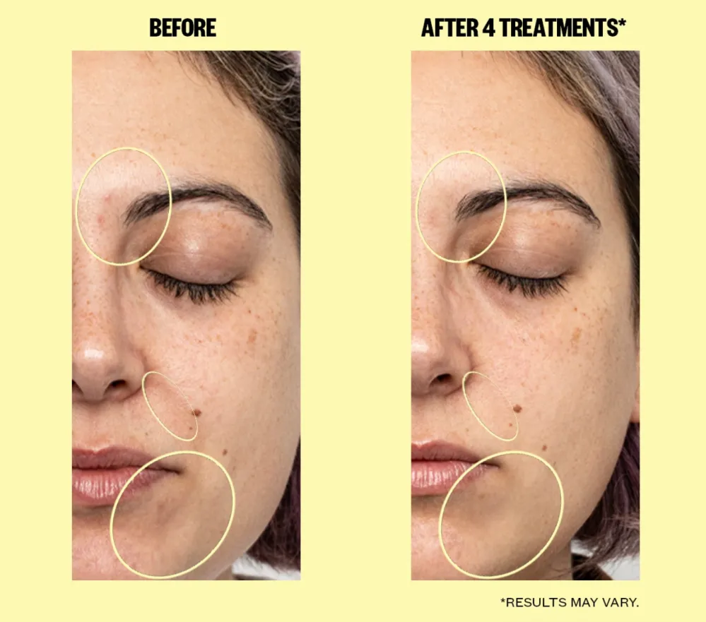 Dullness One-Step Brightening Face Pads