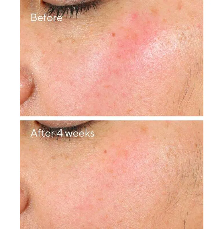 Intense Recovery Cream