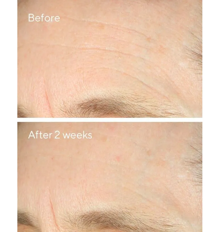 Intense Recovery Cream