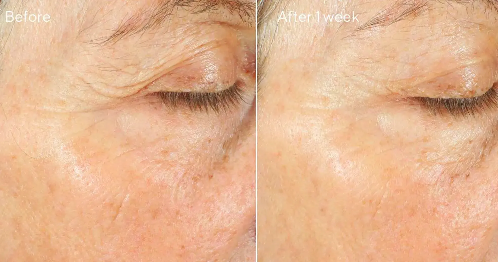 Intense Recovery Cream