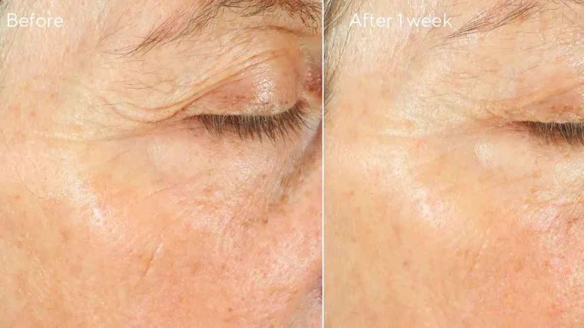 Intense Recovery Cream