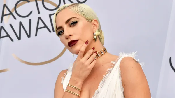 Lady Gaga Dognapper Eyewitness Believes Incident Was ‘Planned Out’