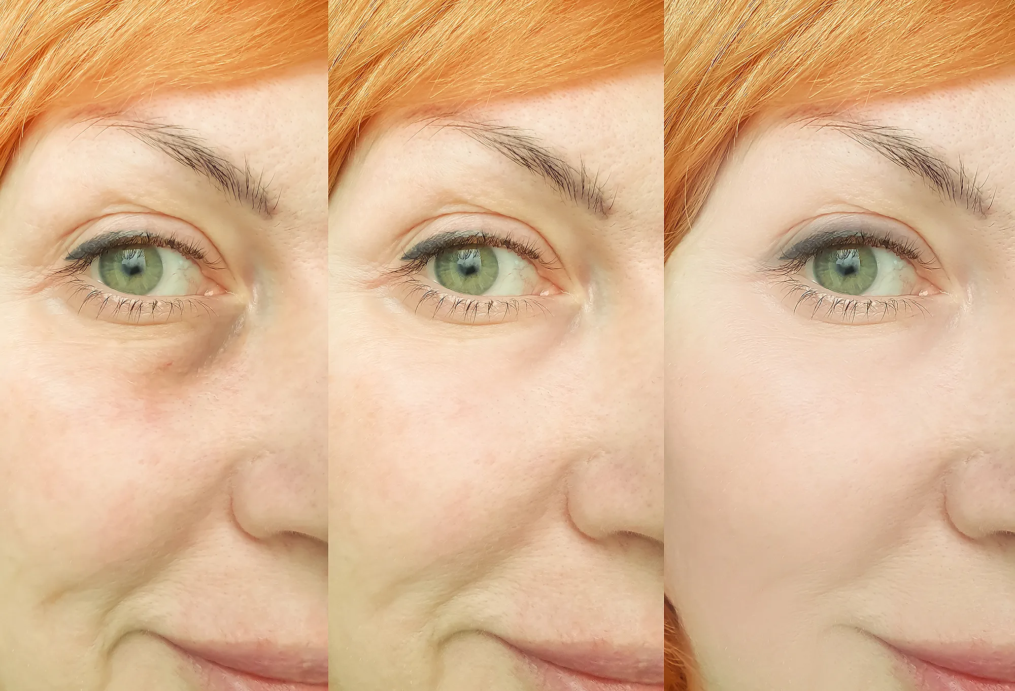 before-after-wrinkles-aging