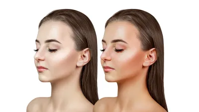 bronzer-before-after