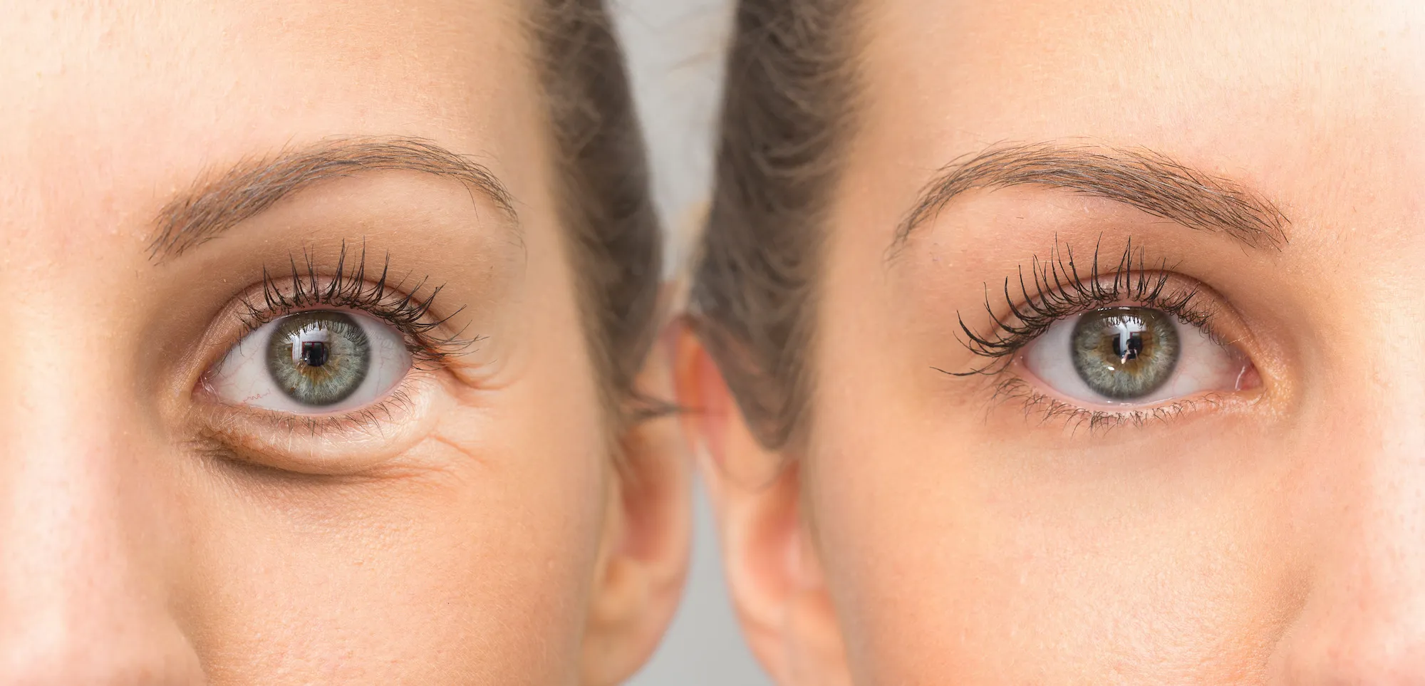 Before-After-Eye-Cream-Stock-Photo