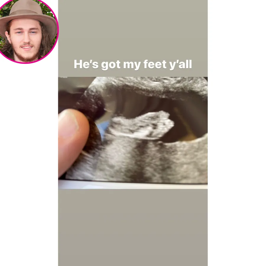 Braison Cyrus ultrasound