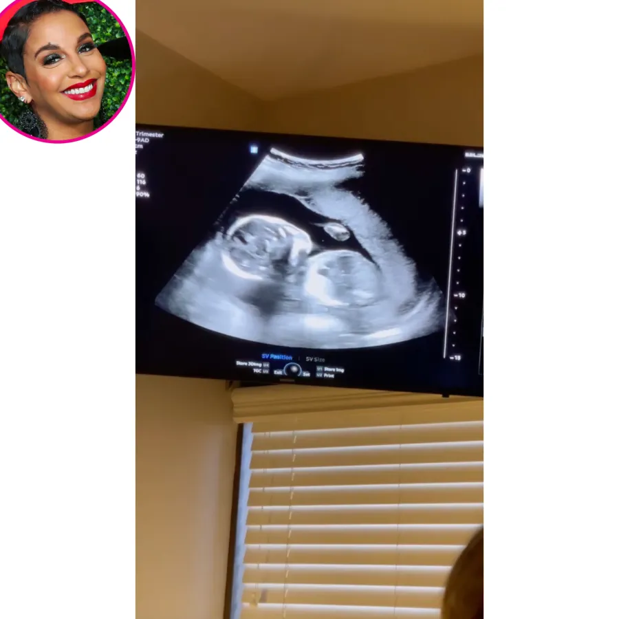 Crystal Smith ultrasound