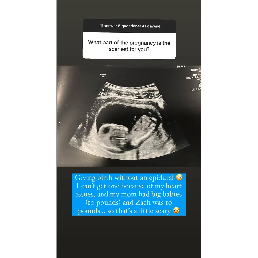 Pregnant Challenge Alum Jenna Compono Explains Why No Epidural ulta sound