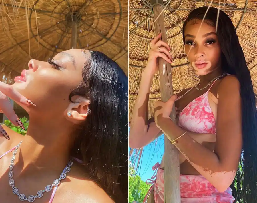 Winnie Harlow Pairs Bikini With Estimated $1.5 Million Worth of Diamonds