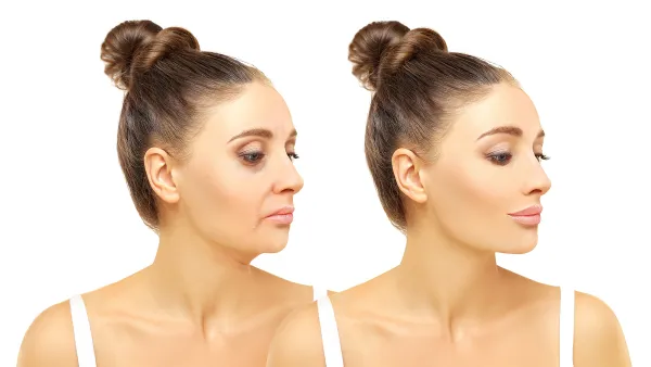 hourglass-serum-anti-aging-before-after