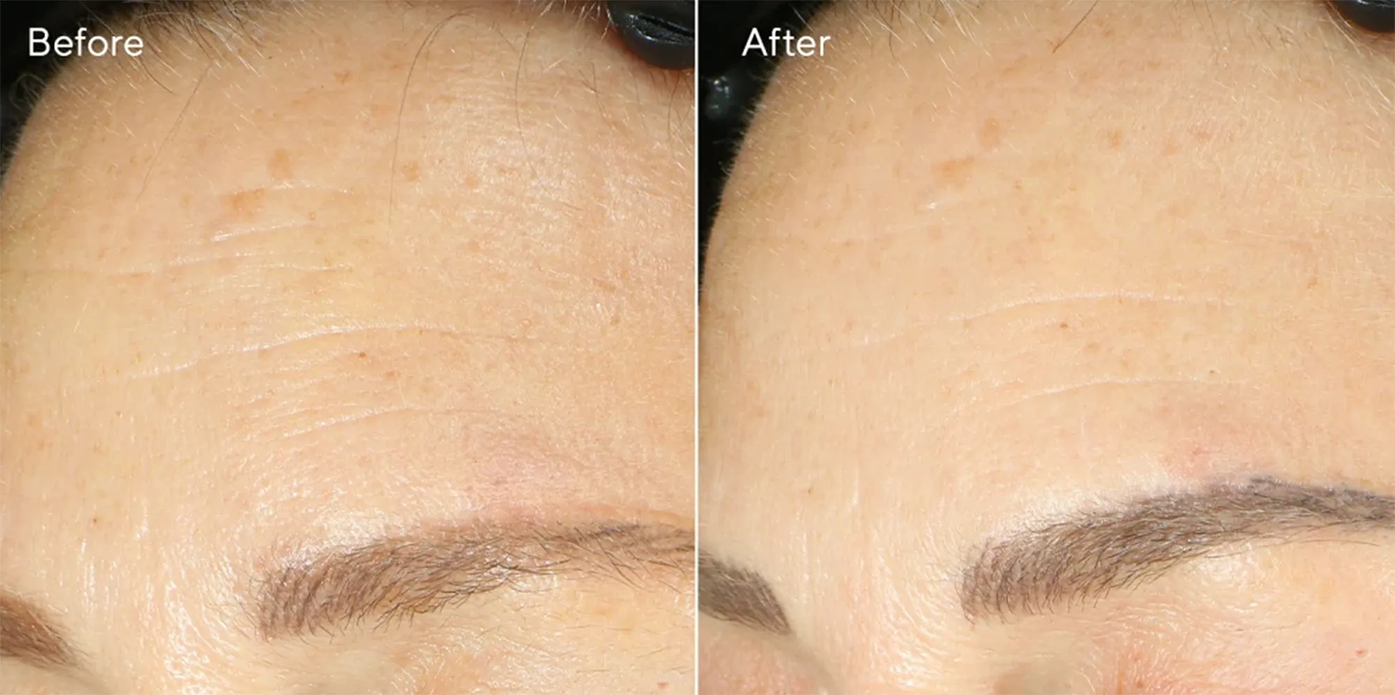 Retinol Youth Renewal Night Cream