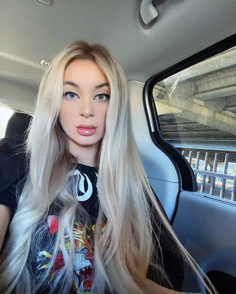 Yara Zaya 90 Day Fiance Stars Who Have Spoken Out About Getting Plastic Surgery