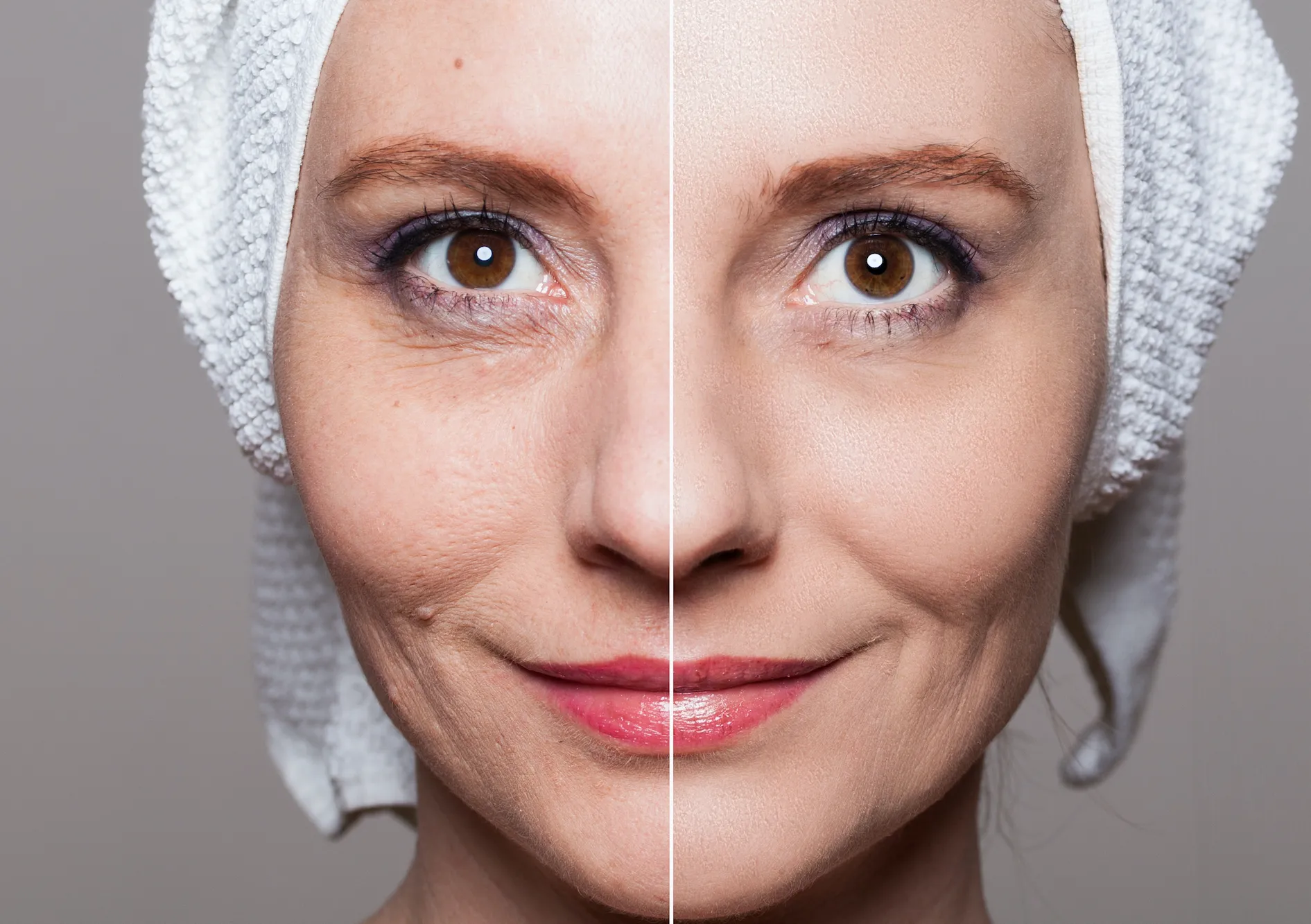 Before-After-Wrinkles-Stock-Photo