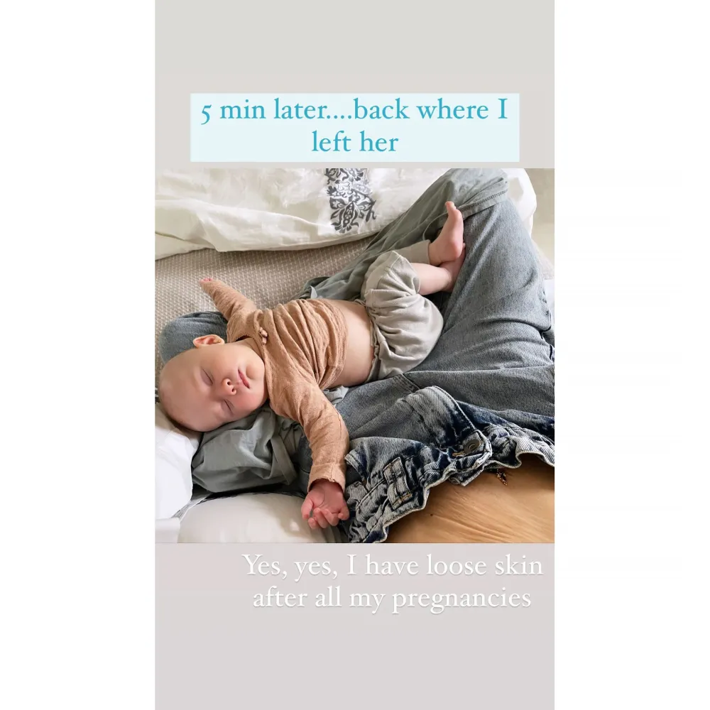 Hilaria Baldwin Proudly Displays 'Loose Skin' 7 Months After Giving Birth