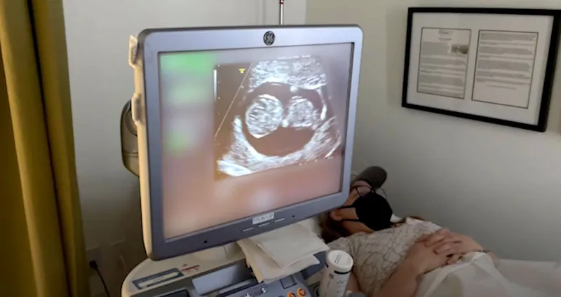 Ronda Rousey Travis Browne Ultrasound Photos