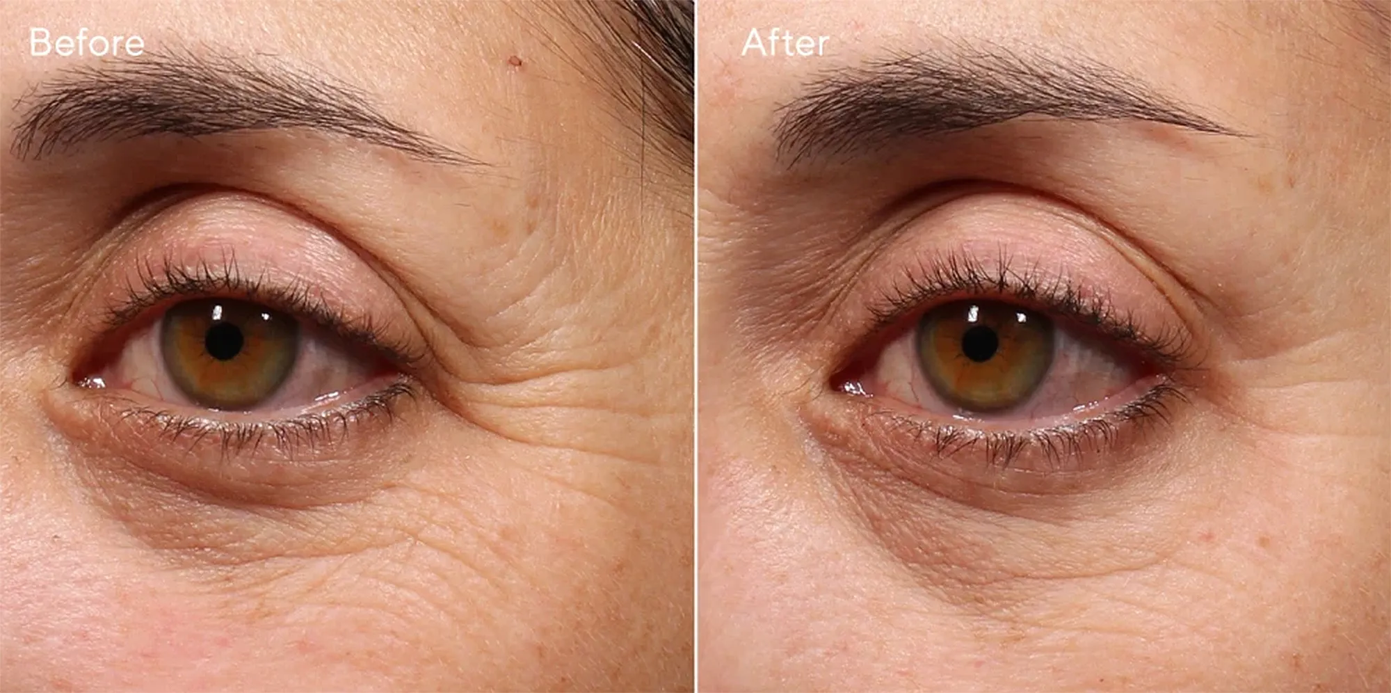 murad-retinol-eye-youth-serum