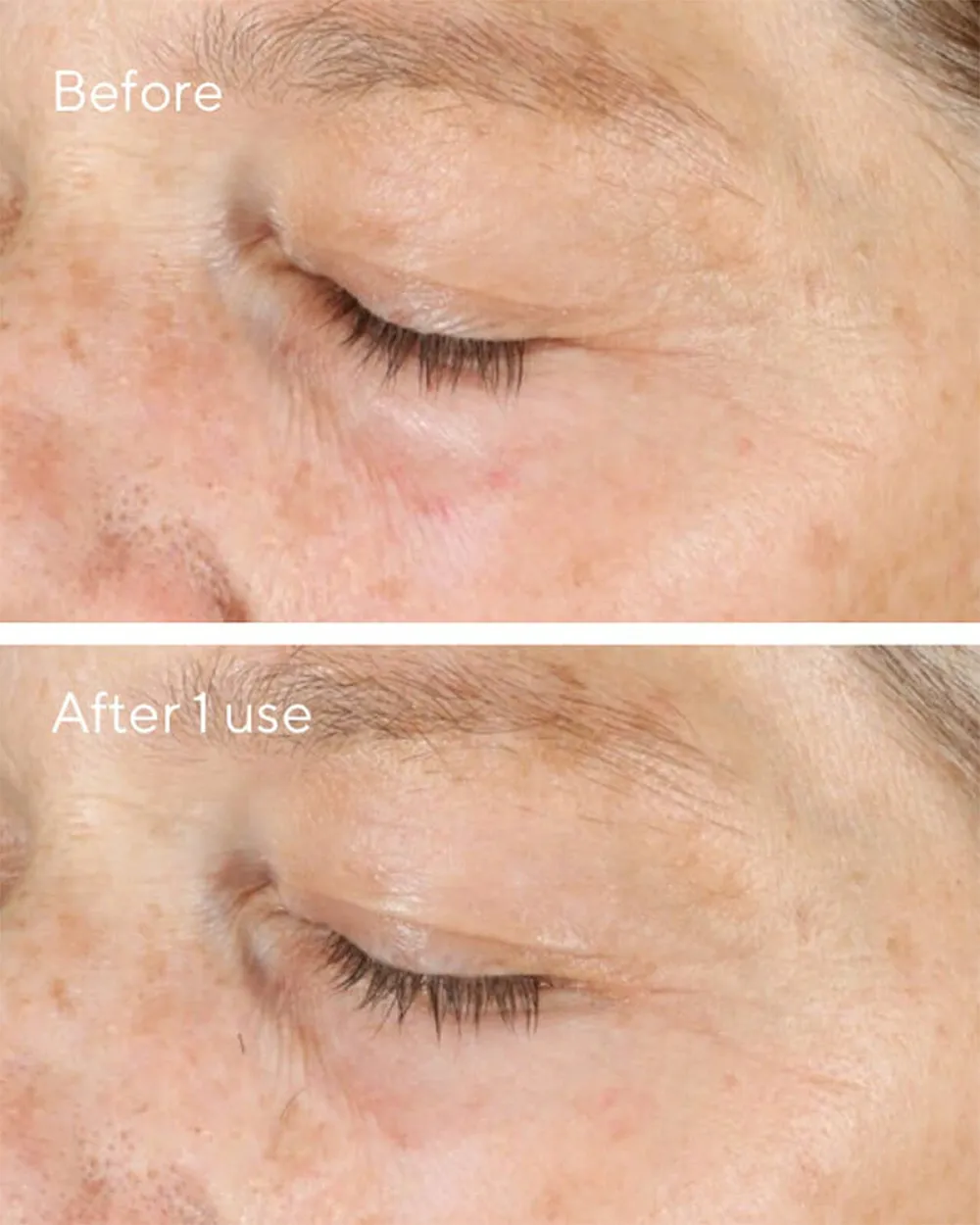 murad-vita-c-scrub-before-after