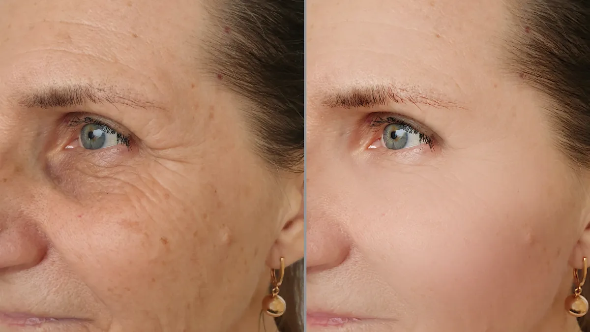 Anti-Aging-Stock-Photo