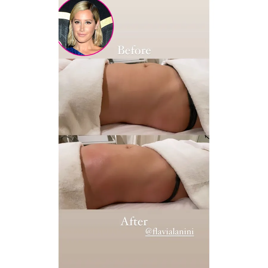 Ashley Tisdale Shows Postpartum Body 2 Months After Giving Birth to Daughter Jupiter Gallery