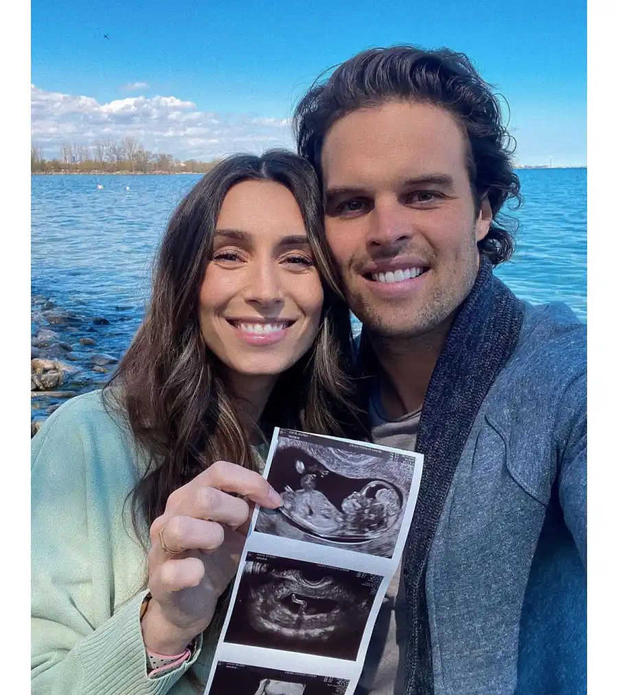 Bachelor in Paradise Astrid Loch Kevin Wendt Ultrasound