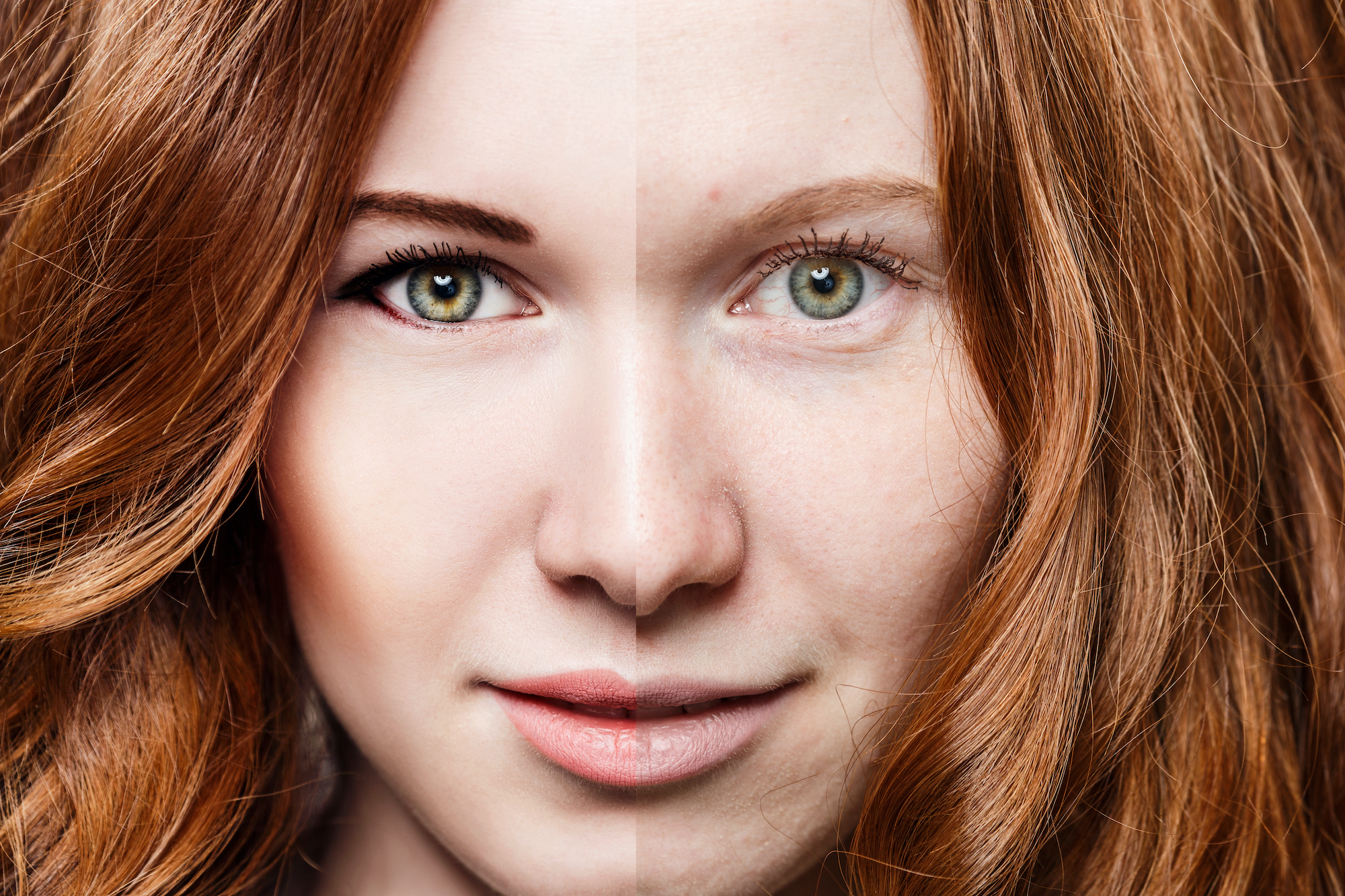 Before-After-Bright-Skin-Stock-Photo