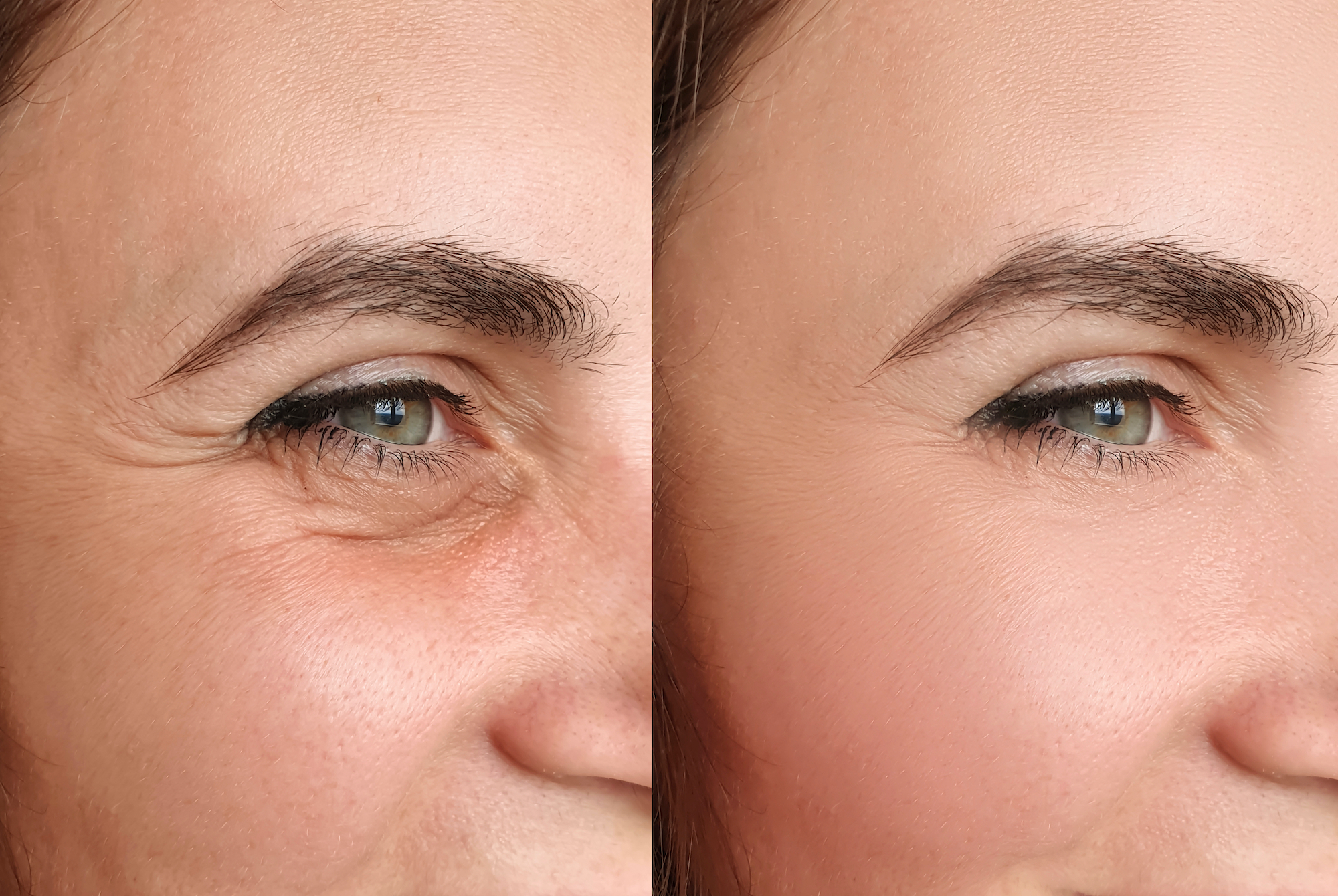 Before-After-Skin-Primer-Stock-Photo
