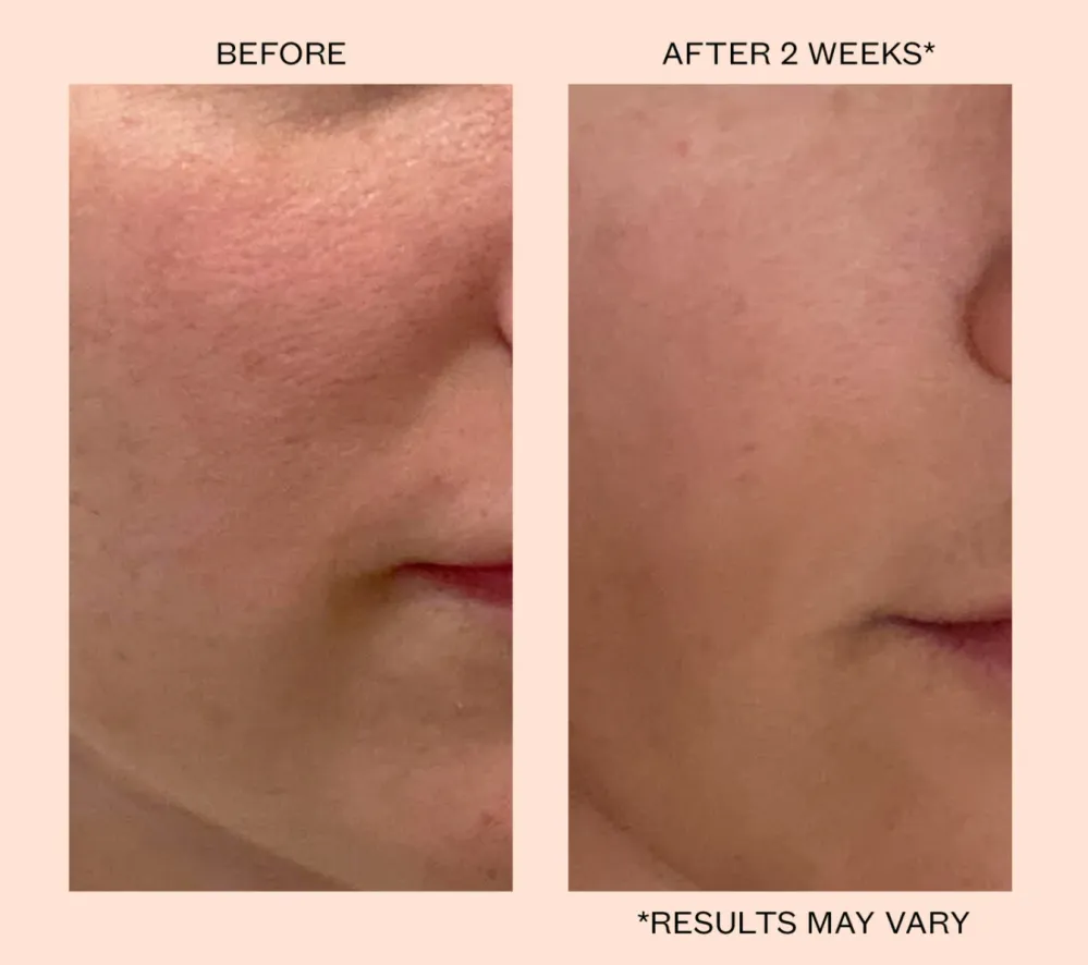 Cleansing Blemish Balm