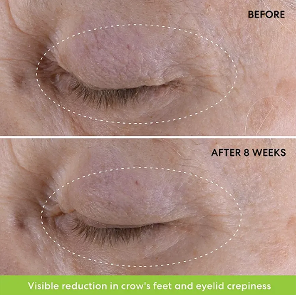 bareminerals-eye-cream-before-after