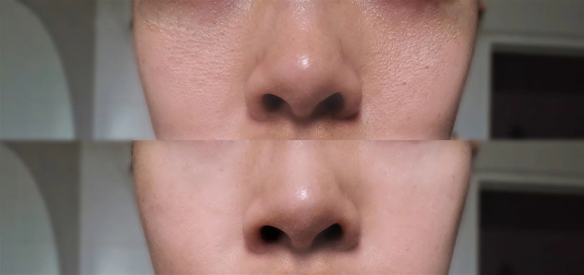 before-after-pores