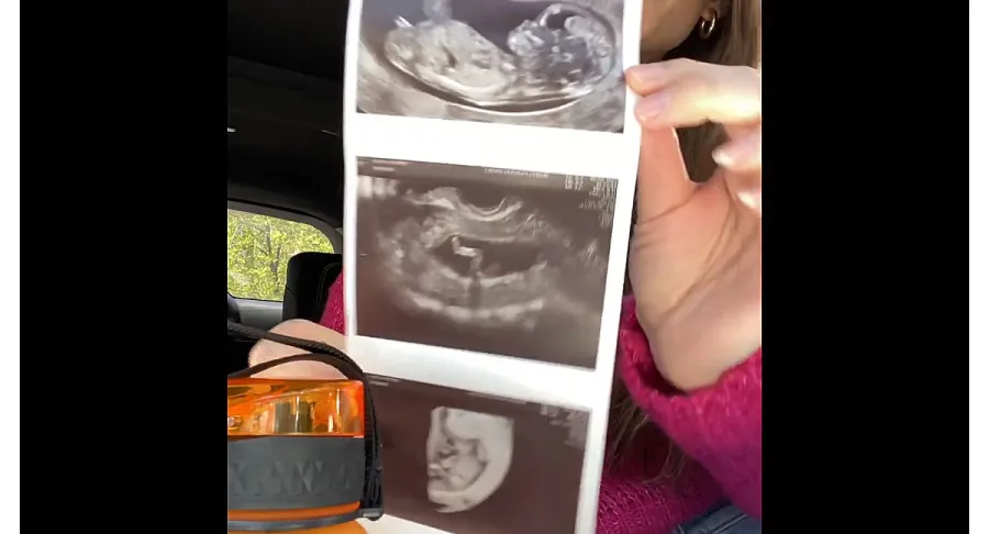 Bachelor Pregnant Astrid Loch Gives Glimpse of Post-IVF Transfer Journey 3