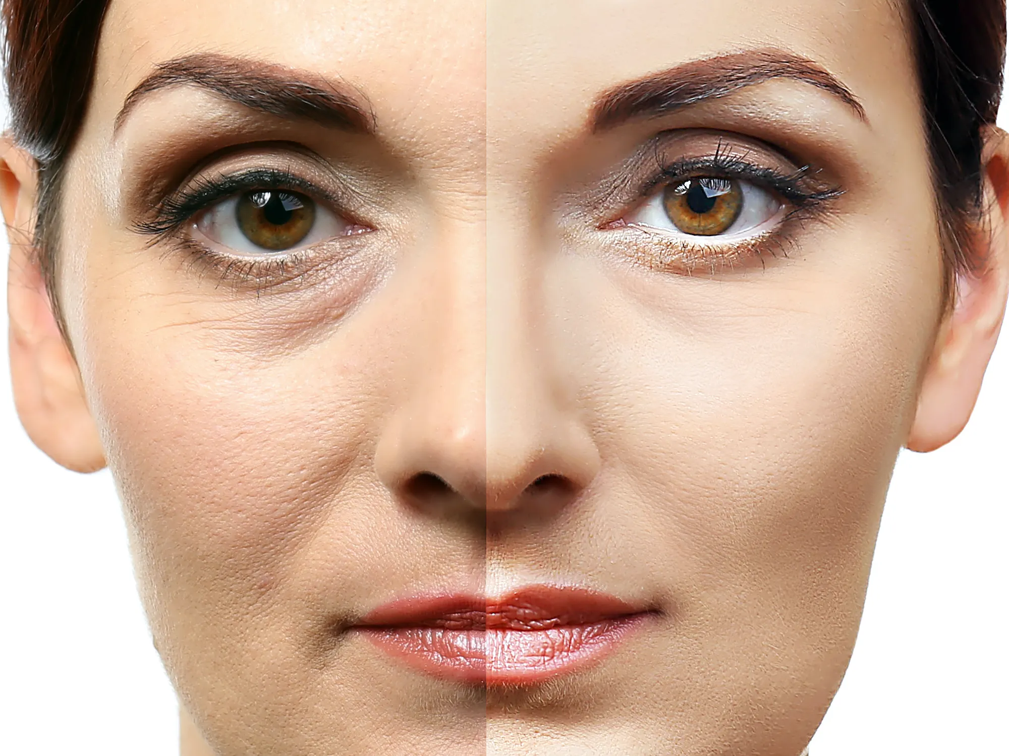 Before-After-Eye-Brightening-Stock-Photo