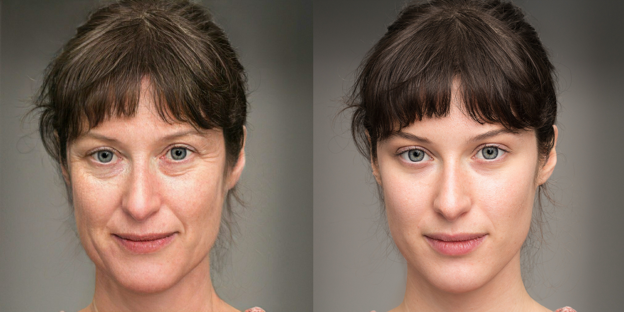 Before-After-Wrinkle-Smoother-Stock-Photo