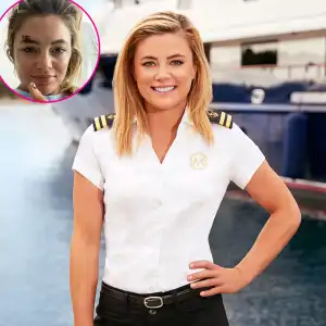 Below Deck Mediterranean Malia White Hospitalized in Spain Following Scooter Accident