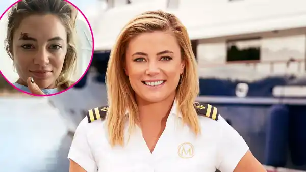 Below Deck Mediterranean Malia White Hospitalized in Spain Following Scooter Accident
