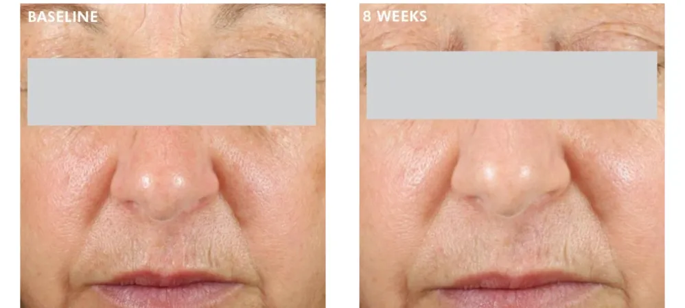 Daily Brightening UV Defense Sunscreen SPF 30