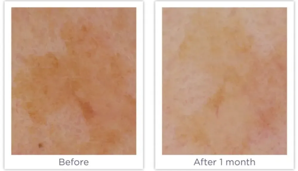 Enhance Brightening Serum