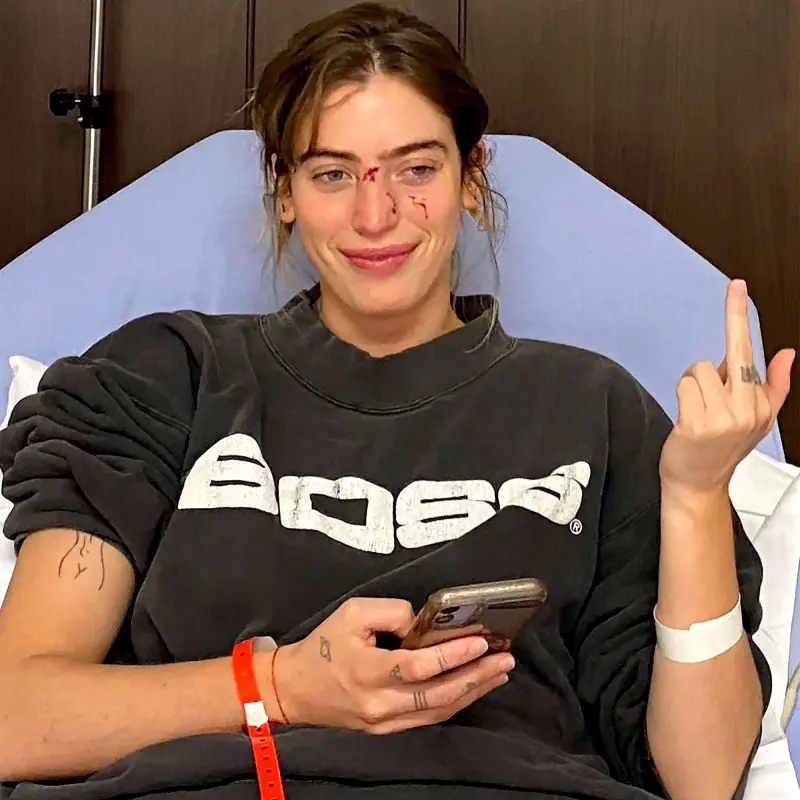 Ewan McGregors Daughter Clara Is Bitten Face by Dog Ahead The Birthday Cake Premiere