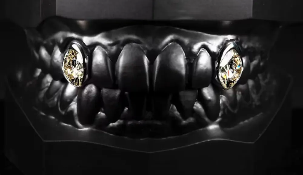 Post Malone Spends $1.6 Million on Diamond-Encrusted Veneers