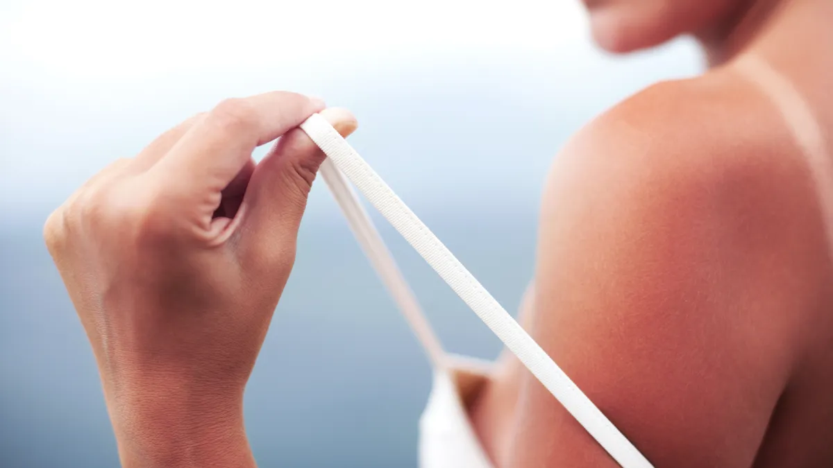 Sunburt-Skin-Stock-Photo