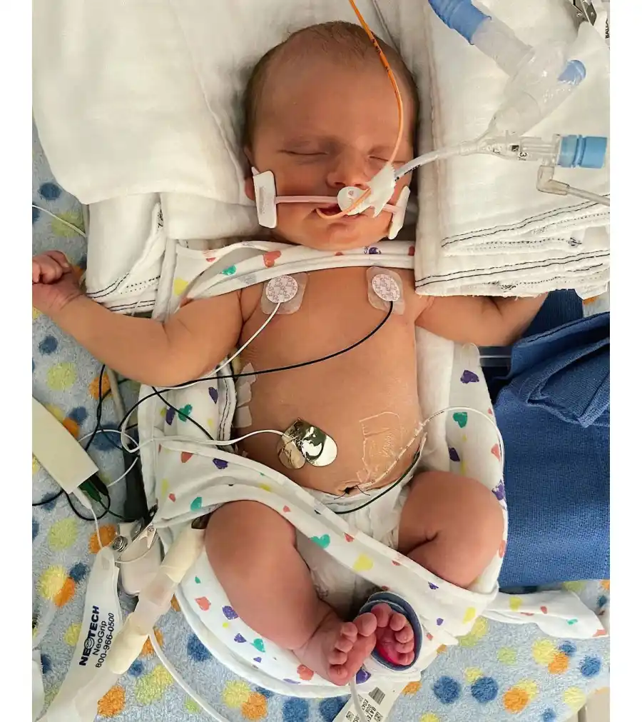 Whitney Bates Son Jadon Improving After Right Lung Collapse 1