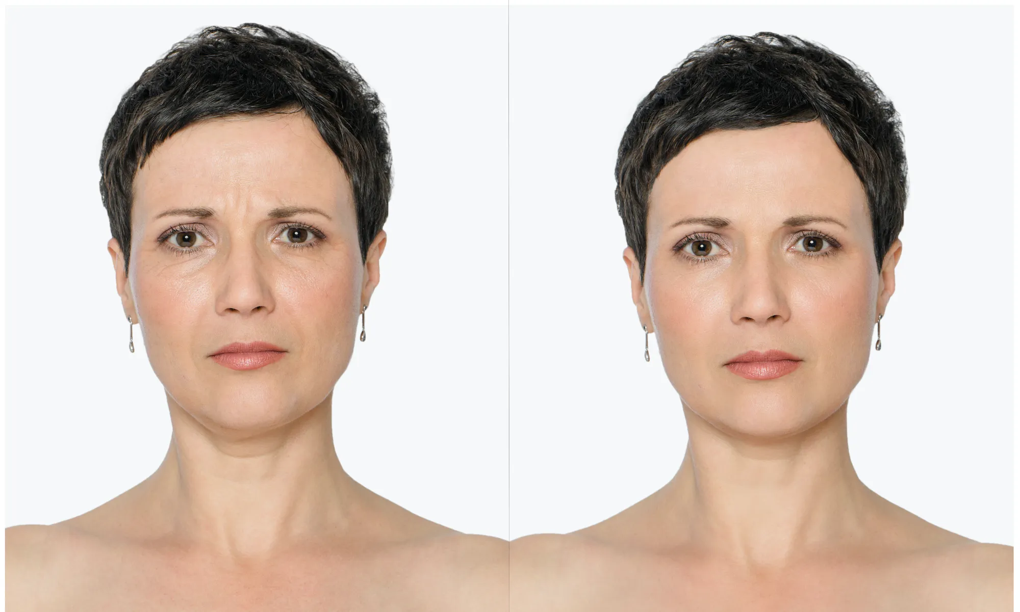 Before-After-Aging-Stock-Photo