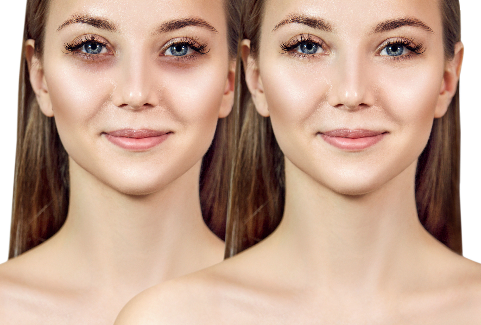 Before-After-Concealer-Stock-Photo