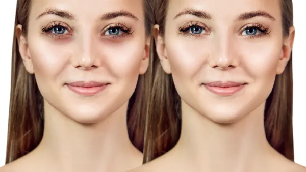 Before-After-Concealer-Stock-Photo