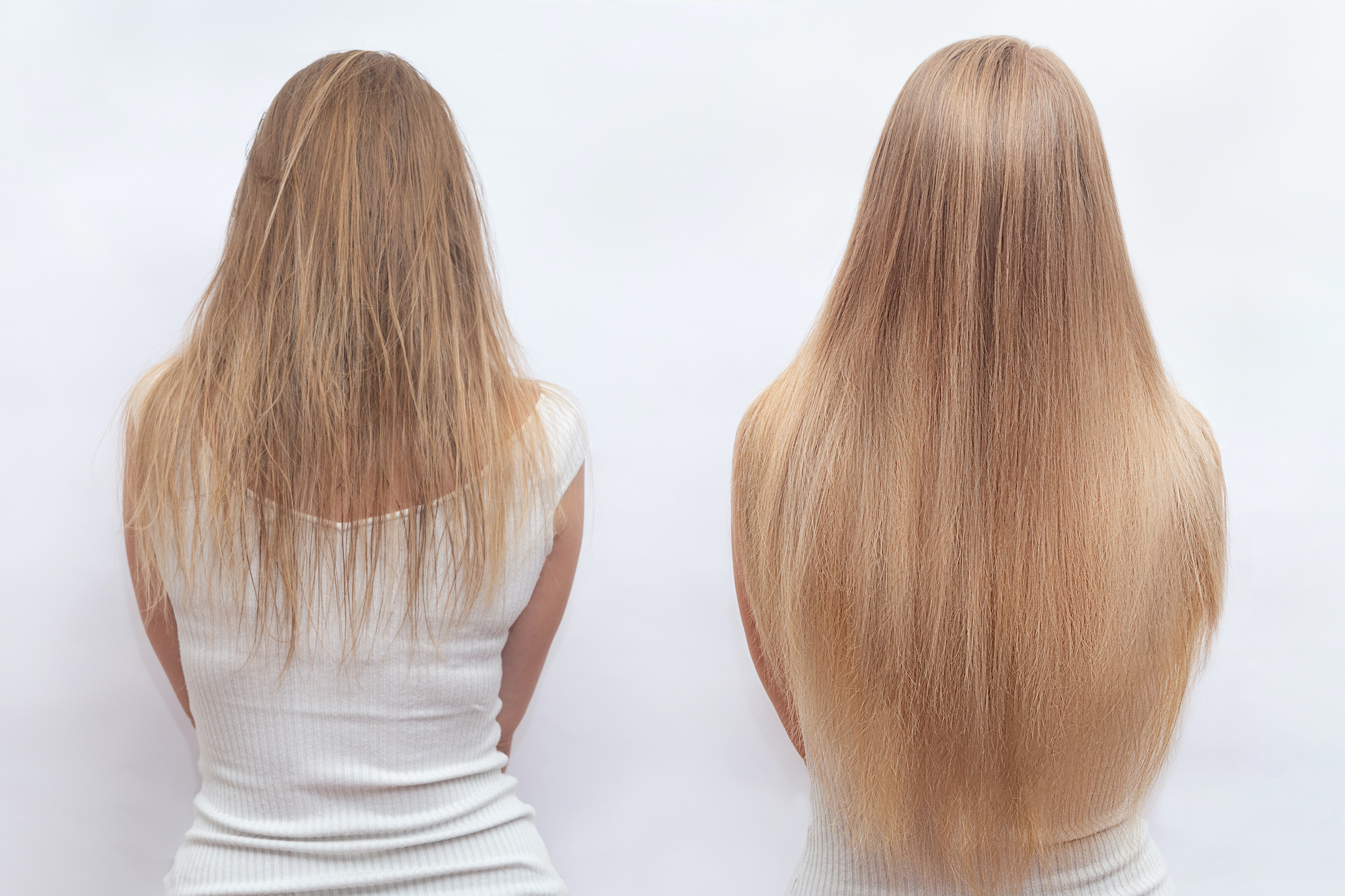 Before-After-Hair-Growth-Stock-Photo